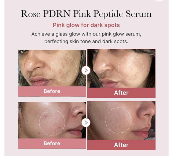 Medicube PDRN Pink Peptide Serum (30 ml) - Image 4